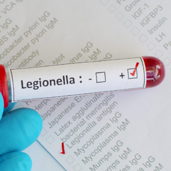 Basic Legionella Management